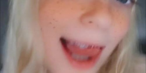 Do you like.. my braces My braces ^_* by minxiybitez from OnlyFans | Coomer