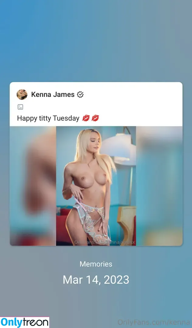 kenna - Onlytreon Part 1 (75 photos)