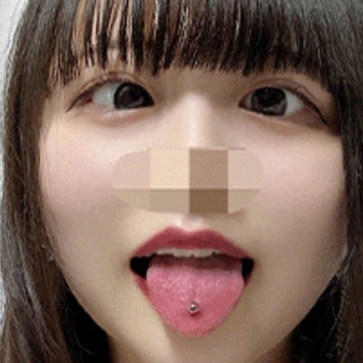Noa01